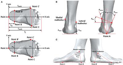 Bilateral ankle deformities affects gait kinematics in chronic stroke patients